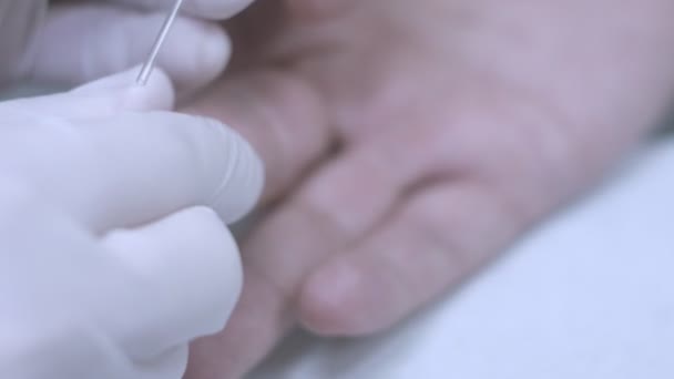 A tirar amostras de sangue do dedo. Close up de mãos na luva desenhar dedo do sangue — Vídeo de Stock