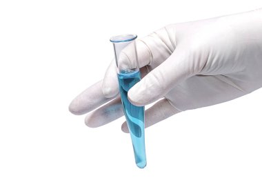 Tıbbi kavramı: lastik eldiven ile mavi sıvı tüp Holding doktor el
