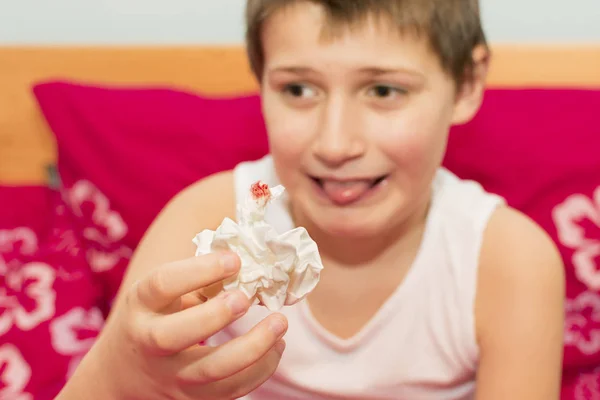 The boy stops bleeding from his nose with a handkerchief — Stock Photo, Image