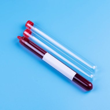 Mavi arka planda analiz için test tüpündeki kan örneği. Uzayı kopyala İlaçlar. Analizler. Virüsler.