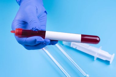 Doktorlar tıbbi eldiven veriyorlar. Bir mavi üzerinde analiz için test tüpünde kan örneği. Uzayı kopyala. İlacı. Analizler. Virüsler.