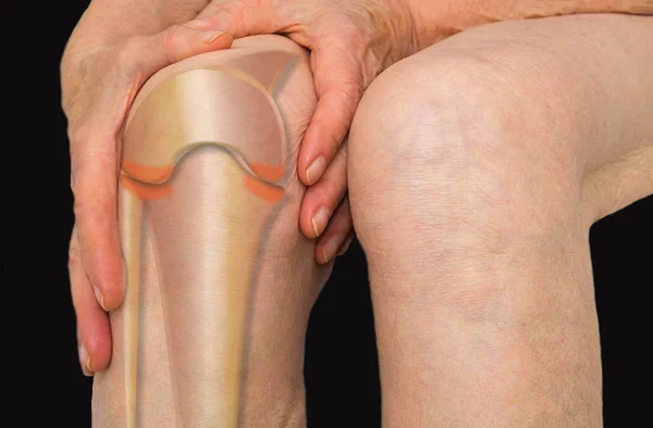 Mujer mayor sosteniendo la rodilla con dolor — Foto de Stock