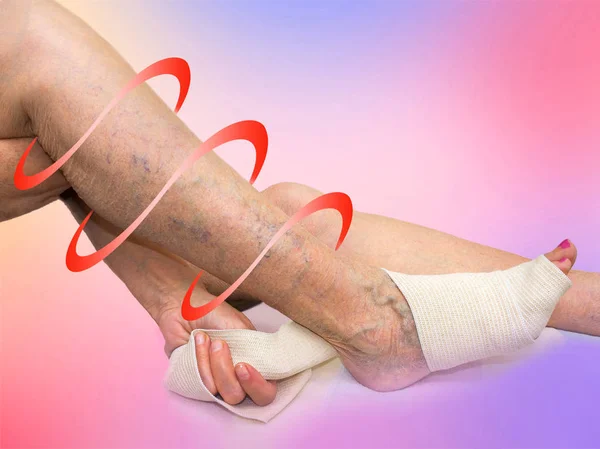 Senior kobieta korygowanie bandaż elastyczny, który związany jej nogi. — Zdjęcie stockowe