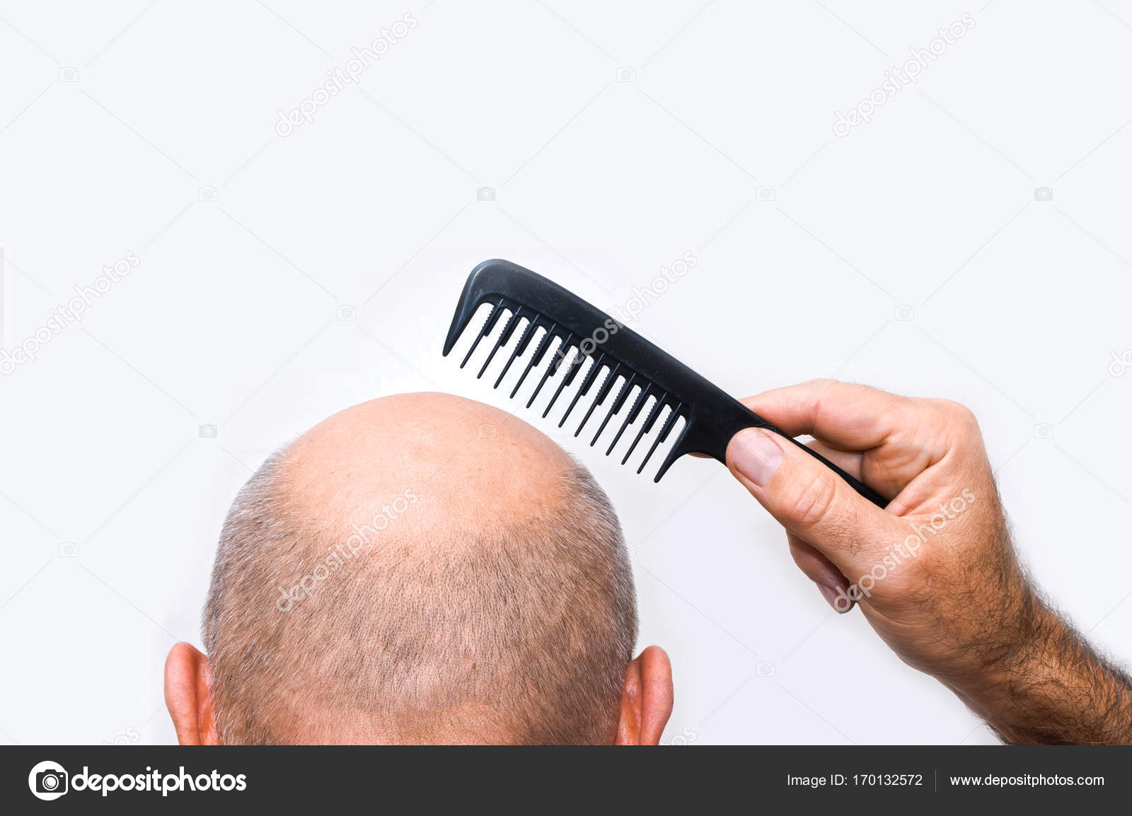 Alopécie humaine ou perte de cheveux - homme adulte main tenant peigne  image libre de droit par Marina113 © #170132572