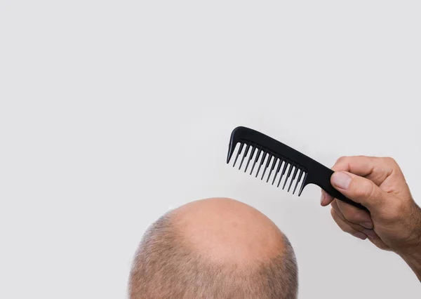 Alopecia humana ou perda de cabelo - homem adulto mão segurando pente — Fotografia de Stock