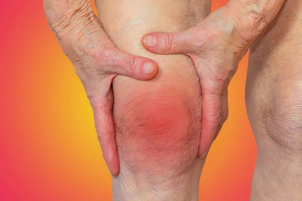 Ανώτερος γυναίκα κρατώντας το γόνατο με πόνο — Φωτογραφία Αρχείου