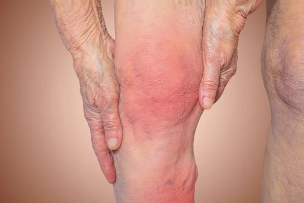 Ανώτερος γυναίκα κρατώντας το γόνατο με πόνο — Φωτογραφία Αρχείου