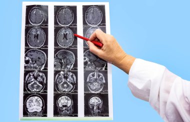 Manyetik rezonans görüntüsü veya beynin MR 'ı