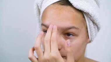 Banyo havlusu giymiş genç bir kız yüzüne dokunuyor ve cildinde sorun var.