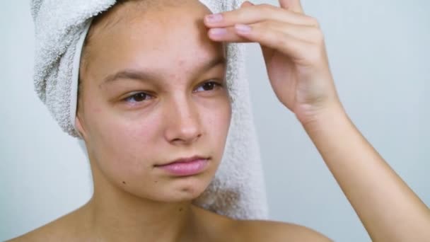 Menina adolescente pessimista examinando seu rosto com acne após o banho — Vídeo de Stock