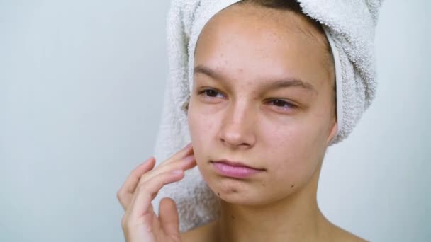 Tonårstjej med badhandduk på huvudet olycklig med akne i ansiktet — Stockvideo