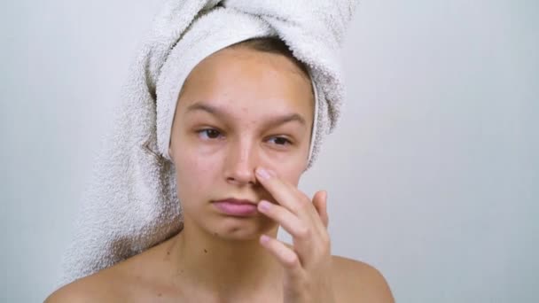 Triste adolescente senza maglietta esaminando il suo viso con problemi di pelle dopo il bagno — Video Stock