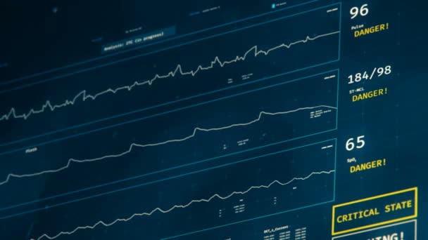 Surveillance futuriste des soins intensifs, aggravation de l'état des patients, mort subite à l'écran 