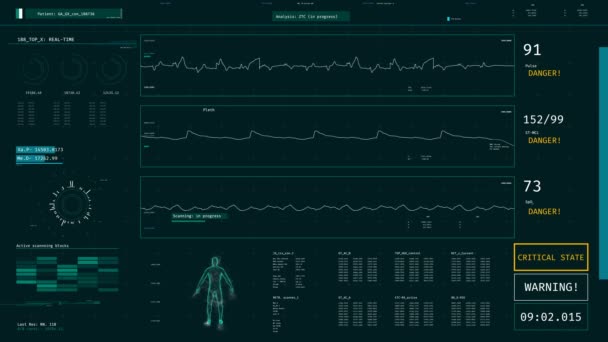 ICU monitor met waarschuwing, patiënt sterven, vital signs dropping op scherm — Stockvideo