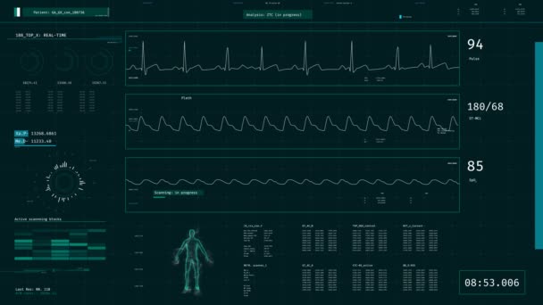 ICU monitor weergegeven: de toestand van de patiënt, de gezondheid, de vitale functies. Modern ontwerp — Stockvideo