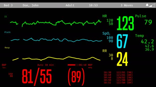 Icu-Screening-Überwachung sterbender Patienten, fallende Vitalzeichen, klinischer Tod — Stockvideo