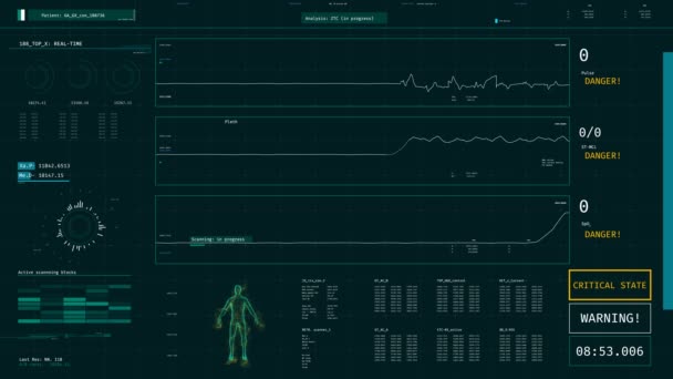 Odrodzenie pacjenta, monitor Icu z życiowych rośnie po zawale — Wideo stockowe