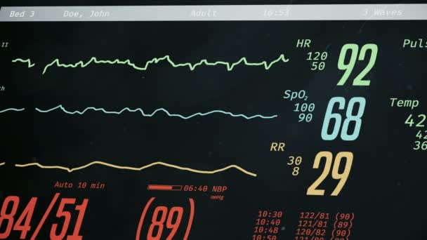 Patient dying, ICU monitor with dropping vital signs, cardiac arrest, death — Stock Video