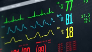 Normal vital bulguları monitörde başucu yoğun bakım, hasta kalp ameliyatından sonra kararlı