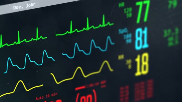 Toestand van de patiënt de gecontroleerd op intensive care, scherm met vital signs — Stockvideo