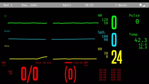 Patiënt heropleving na klinisch dood, vital signs stijgt op Icu monitor — Stockvideo