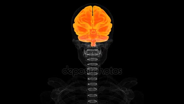İnsan beyni tıbbi tarama sonuçları ekranında, MRI, hastanın hastalığı teşhis — Stok video