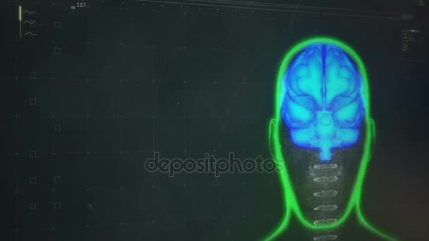 ソフトウェアの画面で、未来的な診断患者の脳のスキャン結果を表示 — ストック動画