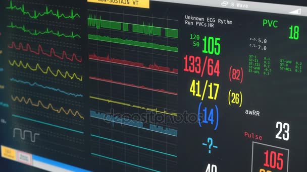 Monitor médico da UTI, estado do paciente piorando, batimento cardíaco irregular — Vídeo de Stock