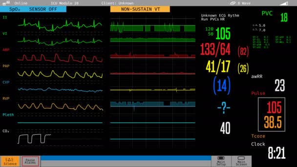 Monitor médico de la UCI que muestra la condición del paciente enfermo, atención hospitalaria, tratamiento — Vídeos de Stock