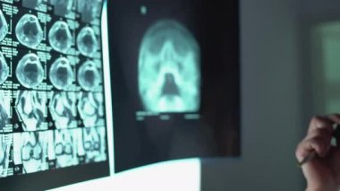Gözlüklü uzman bir cerrah MRI görüntüsüne, hastalığın tedavisine, işe bakıyor