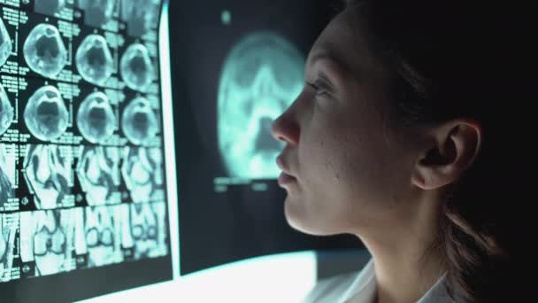 Médecin féminin examinant l'image IRM, pensant au diagnostic, maladie grave — Video