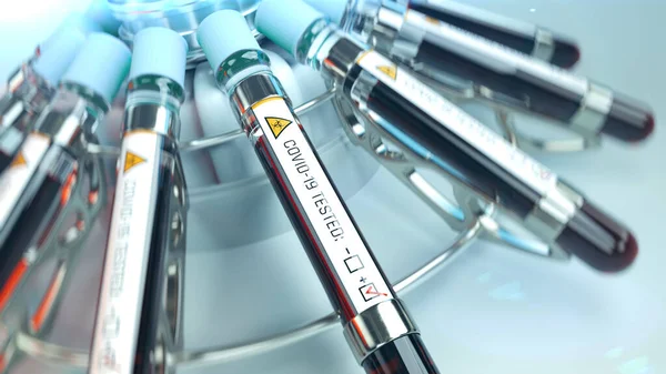 COVID-19 koronavirüs testi, kan örnekleriyle santrifüj test tüpleri.