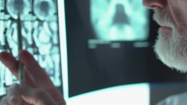 Kıdemli doktor tomografik görüntüyü analiz ediyor, çene ve sağlık hizmetlerinde el ele tutuşuyor.