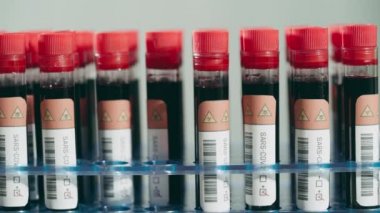 Laboratuvar çalışanı tüpleri rafa kaldırıyor, pozitif koronavirüs test sonuçları, araştırma...