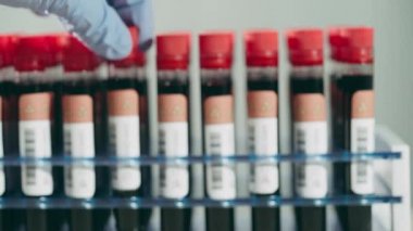 Laboratuvar çalışanı kan örneğiyle tüp gösteriyor, negatif koronavirüs testi sonucu.