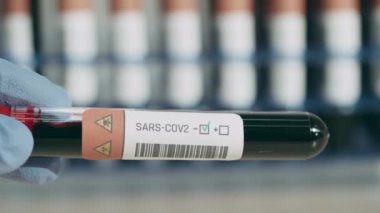 Negatif koronavirüs testi arka planda laboratuvar rafı ve tedavi ile sonuçlanır