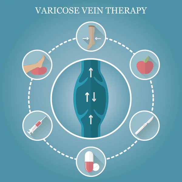 Flebologia infográfica, tratamento de varizes nas pernas das mulheres — Vetor de Stock