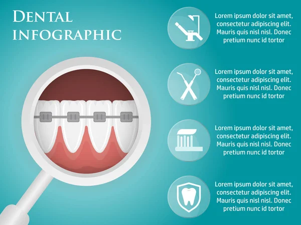 Infografías dentales de diseño de plantilla — Vector de stock