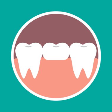 Vektör çizim simgesini diş köprü. Ortodonti, diş küçük şeytan