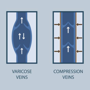 Varis ve sıkıştırma ven vektör çizimi. 