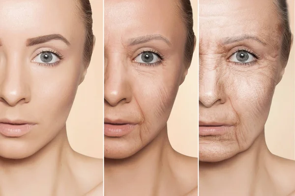 anti-aging procedures on caucasian woman face