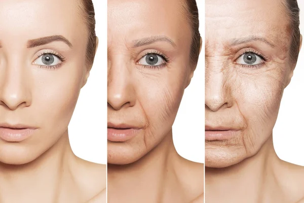 Anti-aging procedures on caucasian woman face — Stock Photo, Image