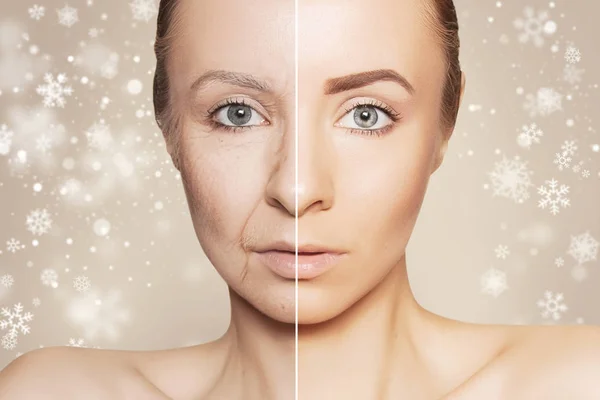 Konsep revitalisasi wajah sebelum dan sesudah prosedur — Stok Foto