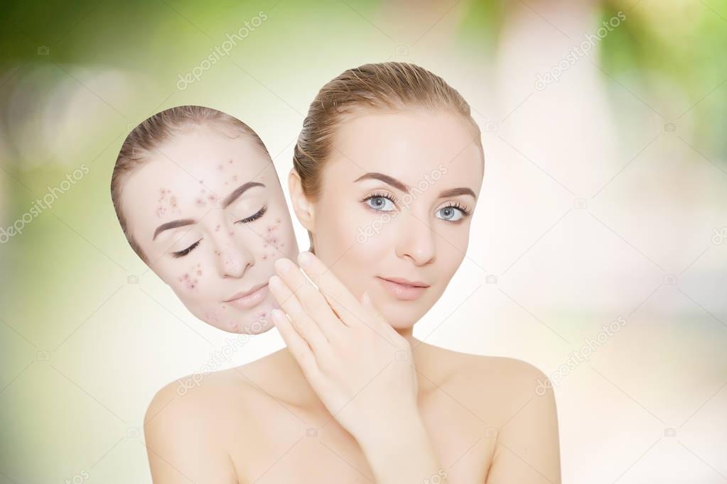woman takes away mask with acne and pimples,green outdoor backgr