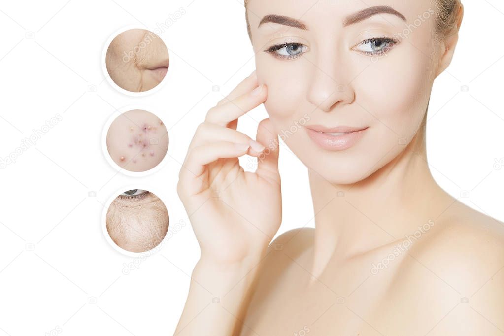 portrait of young woman face with circles of bad problem skin 