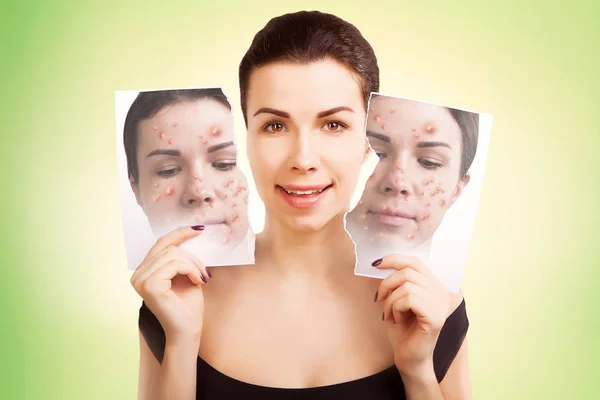 young woman fights ugly skin, skincare concept