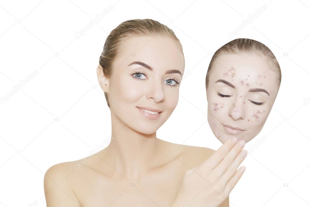 woman takes away mask with acne and pimples,white background