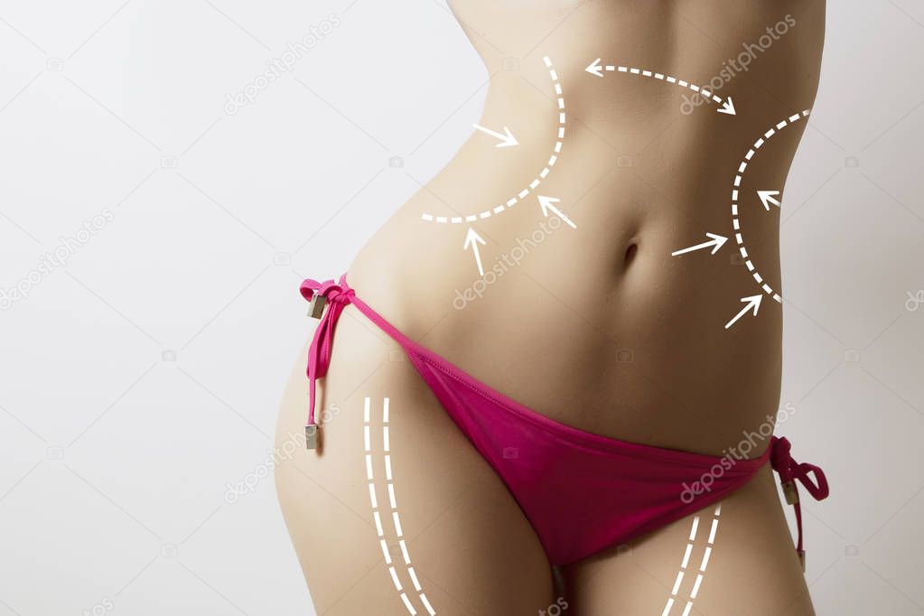 slim woman body with marks on stomach