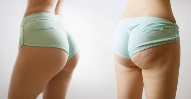 kadın vücut önce ve sonra şekil fitness transformantion