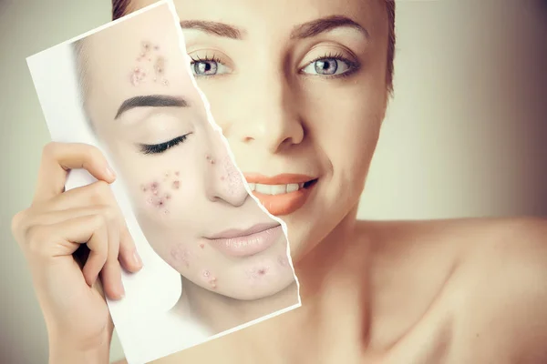 woman face portrait with photo of her old skin